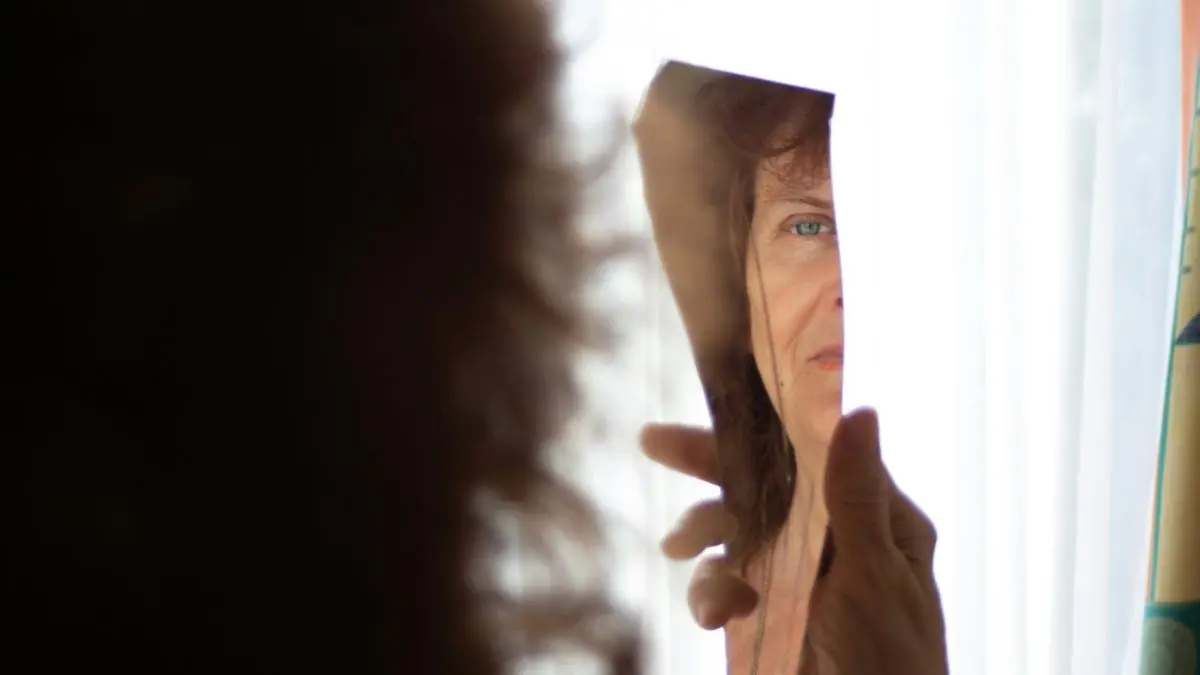 Self-Image: The Scar Only You Can See