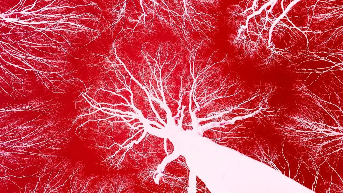Artistic tree branches form a network resembling blood vessels.